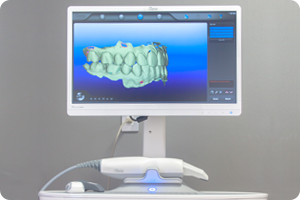 先進の光学3Dスキャナー「iTero element」で歯型をスキャン